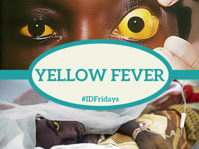 Yellow fever